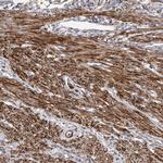 EPRS Antibody in Immunohistochemistry (Paraffin) (IHC (P))