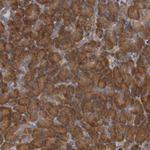 EPRS Antibody in Immunohistochemistry (Paraffin) (IHC (P))