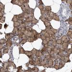 EPRS Antibody in Immunohistochemistry (Paraffin) (IHC (P))