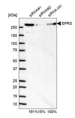 EPRS Antibody in Western Blot (WB)