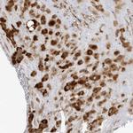 BIKE Antibody in Immunohistochemistry (Paraffin) (IHC (P))