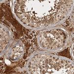 CAMSAP2 Antibody in Immunohistochemistry (Paraffin) (IHC (P))