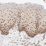 EBNA1BP2 Antibody in Immunohistochemistry (Paraffin) (IHC (P))