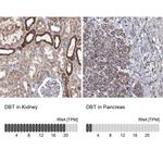 DBT Antibody in Immunohistochemistry (IHC)