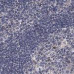 DBT Antibody in Immunohistochemistry (IHC)