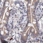 DBT Antibody in Immunohistochemistry (IHC)