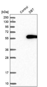 DBT Antibody in Western Blot (WB)