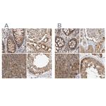 CCBL2 Antibody in Immunohistochemistry (IHC)