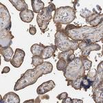 TBCE Antibody in Immunohistochemistry (IHC)