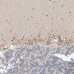 P4HA1 Antibody in Immunohistochemistry (Paraffin) (IHC (P))