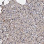 P4HA1 Antibody in Immunohistochemistry (Paraffin) (IHC (P))