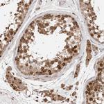 P4HA1 Antibody in Immunohistochemistry (Paraffin) (IHC (P))