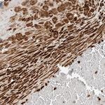 P4HA1 Antibody in Immunohistochemistry (IHC)