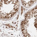 P4HA1 Antibody in Immunohistochemistry (IHC)