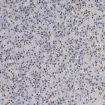 API5 Antibody in Immunohistochemistry (Paraffin) (IHC (P))