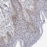 API5 Antibody in Immunohistochemistry (Paraffin) (IHC (P))