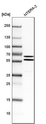 API5 Antibody in Western Blot (WB)