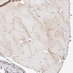 STARD10 Antibody in Immunohistochemistry (IHC)