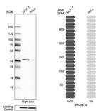 STARD10 Antibody in Western Blot (WB)