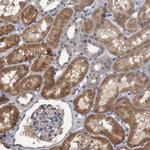 APRT Antibody in Immunohistochemistry (Paraffin) (IHC (P))