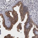 APRT Antibody in Immunohistochemistry (Paraffin) (IHC (P))