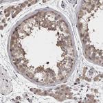 APRT Antibody in Immunohistochemistry (Paraffin) (IHC (P))