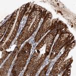 DHDDS Antibody in Immunohistochemistry (Paraffin) (IHC (P))