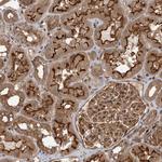 DHDDS Antibody in Immunohistochemistry (Paraffin) (IHC (P))