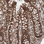 DHDDS Antibody in Immunohistochemistry (Paraffin) (IHC (P))