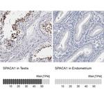 SPACA1 Antibody in Immunohistochemistry (IHC)