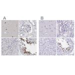 SPACA1 Antibody in Immunohistochemistry (IHC)