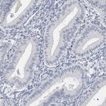 SPACA1 Antibody in Immunohistochemistry (IHC)