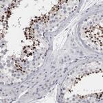 SPACA1 Antibody in Immunohistochemistry (IHC)