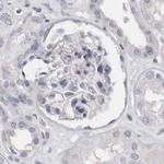 SPACA1 Antibody in Immunohistochemistry (IHC)