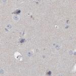 SPACA1 Antibody in Immunohistochemistry (IHC)