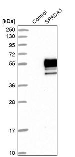 SPACA1 Antibody in Western Blot (WB)