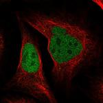 POLD2 Antibody in Immunocytochemistry (ICC/IF)