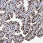 POLD2 Antibody in Immunohistochemistry (Paraffin) (IHC (P))