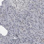 POLD2 Antibody in Immunohistochemistry (Paraffin) (IHC (P))