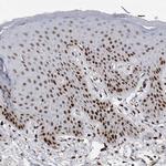 POLD2 Antibody in Immunohistochemistry (Paraffin) (IHC (P))