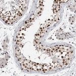 POLD2 Antibody in Immunohistochemistry (Paraffin) (IHC (P))