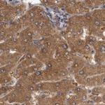 TRMT61B Antibody in Immunohistochemistry (IHC)