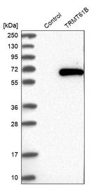 TRMT61B Antibody in Western Blot (WB)