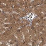 TRMT61B Antibody in Immunohistochemistry (IHC)