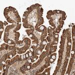 GCNT2 Antibody in Immunohistochemistry (Paraffin) (IHC (P))