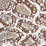 GCNT2 Antibody in Immunohistochemistry (IHC)