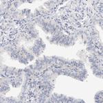 SPINK2 Antibody in Immunohistochemistry (Paraffin) (IHC (P))