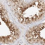 SPINK2 Antibody in Immunohistochemistry (Paraffin) (IHC (P))