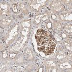 BNIP2 Antibody in Immunohistochemistry (Paraffin) (IHC (P))