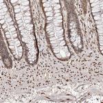 ZNF503 Antibody in Immunohistochemistry (IHC)